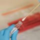 tampone coronavirus